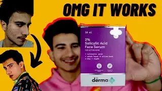 Derma Co. Salicylic Acid | Review in Hindi | #dermaco. #honestreview | the derma co salicylic acid