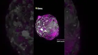 Scientists grow model of human embryo without eggs or sperm | The Federal