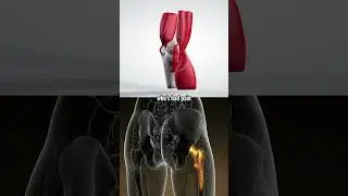 How do I know if I need Total Joint Replacement?? Dr. Nadim Hallal
