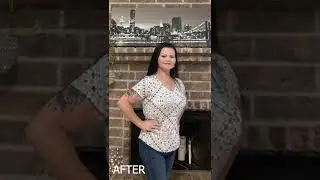 100 Pounds Lost with Our Weight Management Program!