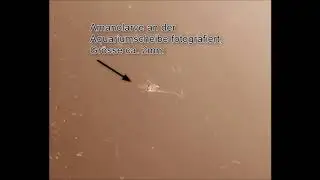 Amanolarve 9 Tage alt