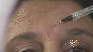 Seen At 11: Products Or Procedures To Get Rid Of Lines And Wrinkles