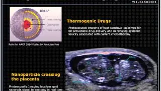 May 2014 Webinar - Imaging Guided Investigation in Cancer Drug Development