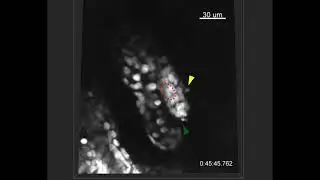 Dying hair follicle stem cell compartment