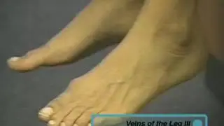 Examination of VENOUS SUPPLY of lower limbs