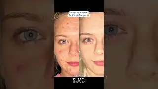 Hi, we're SLMD Skincare by Dr. Pimple Popper 👋