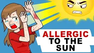 I Am Allergic To The Sun