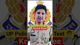 Knock Knees solution  #uppolice #uppolicebharti #shorts #youtubeshorts #upp