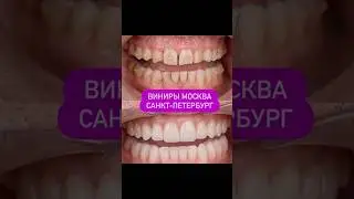 +7999-001-52-55 Москва Санкт-Петербург
