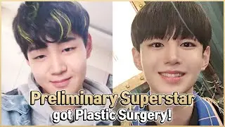 Plastic Surgery in Korea Vlog | Man's Double Eyelid Surgery and Nose Filler