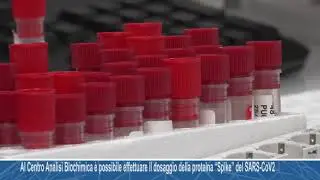 Al Centro Analisi Biochimica è possibile effettuare il dosaggio della proteina “Spike” del SARS-CoV2
