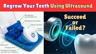 Regrow Your Teeth Using Ultrasound | Medical Miracle