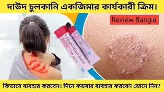 ডেরোবিন মলম এর উপকারিতা || Derobin Ointment Use Bangla || জেনে নিন কি কাজ করে? 