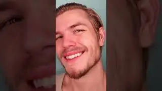Я наношу &laquo;Рогейн&raquo; на лицо каждый день в течение года #шорты