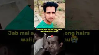 Us🤐 hairline regrowth, hair regrowth treatment for men, #hairregrowth #hairlosstreatment #ytshorts