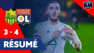 Résumé Nantes - OL | Coupe de France | Olympique Lyonnais