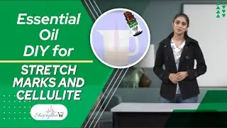 Essential Oils DIY for stretch marks and Cellulite | DIY Oils for Cellulite