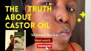 🔥I tried the 7days castor oil on skin challenge‼️⚠️ This happened 😭💔⚠️