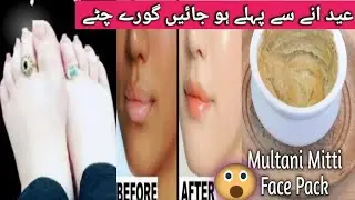 Easy Anti-aging mask glowing skin from multani mitti |Multani Mitti is best solution daily routine