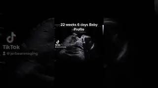 22 weeks 6 days ultrasound #jerbearimaging