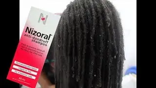 NIZORAL ANTI DANDRUFF SHAMPOO FIRST IMPRESSIONS   HMMMMMM