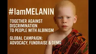 Invisible No More: Albinism, Human Rights, and the Global Fight for Inclusion