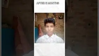 MEWING TRANSFORMATION DURING PUBERTY || RoshannPrajapati || #shorts #foryou #lookmaxing