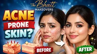Acne skin makeup tutorial  (full base coverage)shocking result #acneskincareroutine #acneproneskin 