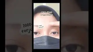 Mellydia Acne Gel ini salah satu produk acne spot treatment terbaik!