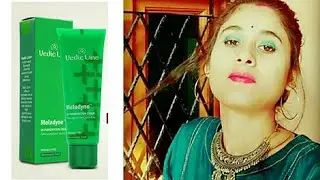 Meladyne de - pigmentation cream Review l Cream for pigmentation,spots ,tan l