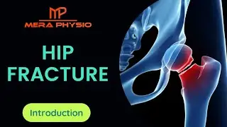 Hip Fracture | Introduction | In Hindi | Mera Physio