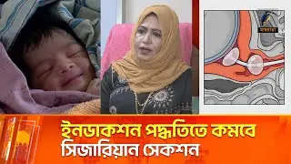 স্বাভাবিক প্রসব বাড়াতে যেভাবে কাজ করছেন অধ্যাপক ডা. মুনিরা ফেরদৌসী | Maasranga News