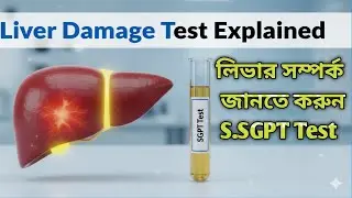 What is SGPT Test? | Liver Function Test! To know if there is a problem with the liver, do this t...