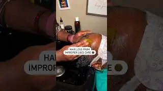 Hair Loss From Improper Locs Care #hairloss #alopecia