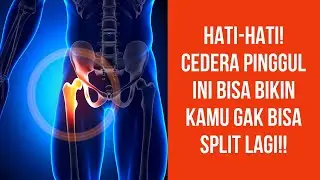 Cedera Pinggul Karena Split Tengah Ini Perlu Diwaspadai!