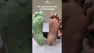 Advance Foot Reflexology Pedicure 🦶🥰#footreflexology #foot #footcare #viral video #trend #chennai