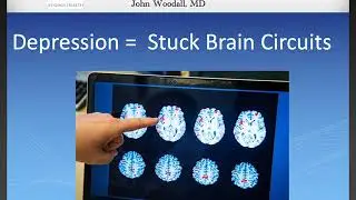 TMS:  Depression is a Stuck Brain Circuit