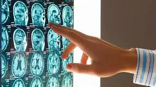 Personal Injury | Minneapolis, MN - Rutzick Law Offices