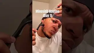 Minoxidil Derma Roller Beard Routine For Beard Growth (day 1)