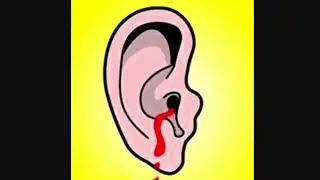 WARNING SUPER LOUD ALL HEADPHONE USERS RIP