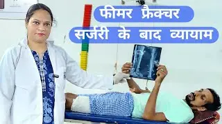 Post surgery femur fracture exercises #femur fracture surgery #which exercises after hip operation