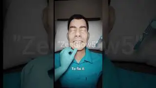how an Elongated uvula in fixed 😮/ZeeGlow5 #3ddance #funny #3danimation  #facialrig #animationblock