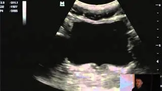 Ultrasound Podcast - Cliff Reid on EFAST