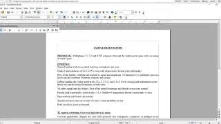DMPE 4 3 working with Clipboard and Autotext
