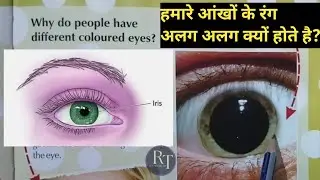 Why do we have different coloured 👁️ 👁️ eyes? Fact about human body| Science facts | Rudra Tutorials