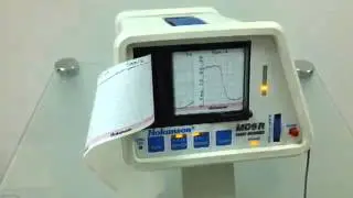 VENOUS PLETHYSMOGRAPHY Pletismograf&iacute;a venosa