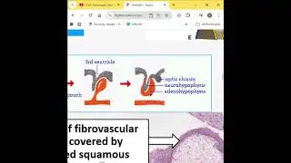 Reproductive First Aid Part 3 embryologic derivatives