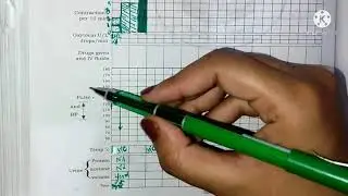 partograph