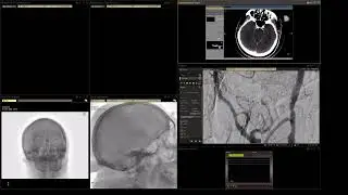 Case-3,  ICAD, 31-01-2026