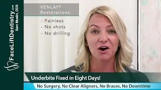 Misaligned Jaw, Protruding Chin, Underbite Fixed in 8-Days